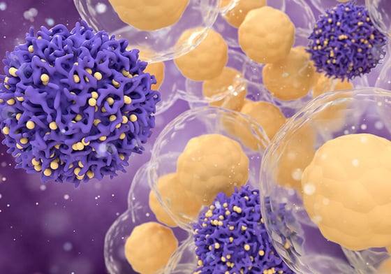 A 3D illustration of purple-colored cancer cells surrounded by transparent immune cells with yellow nuclei